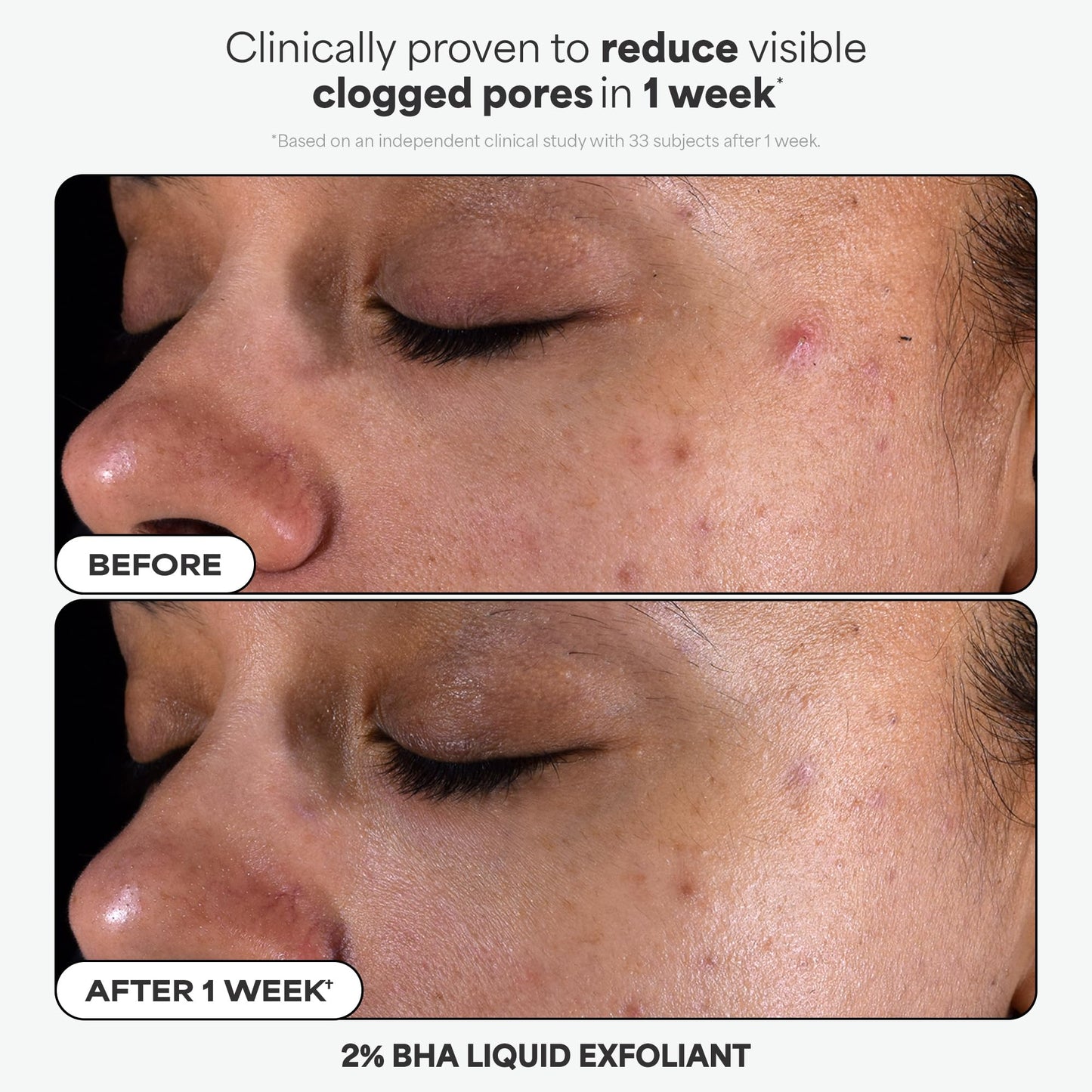Paula’s Choice The Iconic Trio Kit, Travel 2% BHA Liquid Exfoliant, Travel SPF 50 Moisturizer, Full Sized Peptide Gloss Balm, Complete Glow and Lip Care Set