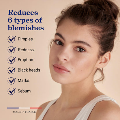Embryolisse Anti-Blemish Face Serum - Anti Pimples & Black Heads Treatment for Oily to Combination Skin, 1.01 Fl Oz