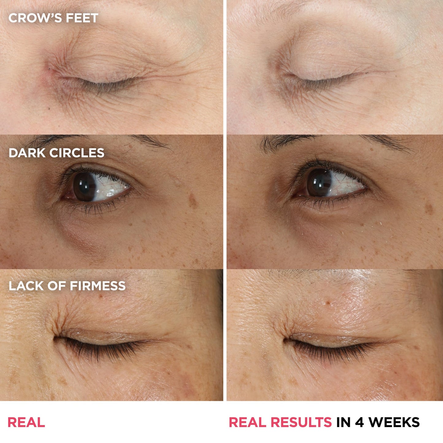 IT Cosmetics Confidence in an Eye Cream - Anti Aging Peptide Eye Cream for Dark Circles & Wrinkles, Lightweight 48HR Hydration, 2% Super Peptide Concentrate, Smooth & Brighten Undereye, All Skin Types