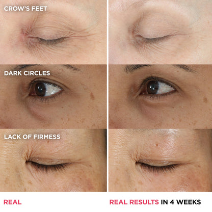 IT Cosmetics Confidence in an Eye Cream - Anti Aging Peptide Eye Cream for Dark Circles & Wrinkles, Lightweight 48HR Hydration, 2% Super Peptide Concentrate, Smooth & Brighten Undereye, All Skin Types