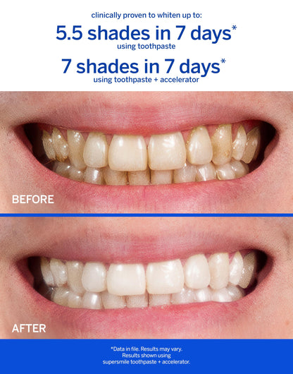 Supersmile Professional Teeth Whitening Toothpaste - Fluoride Free for Visibly Brighter Smile - Whitens up to 6 Shades