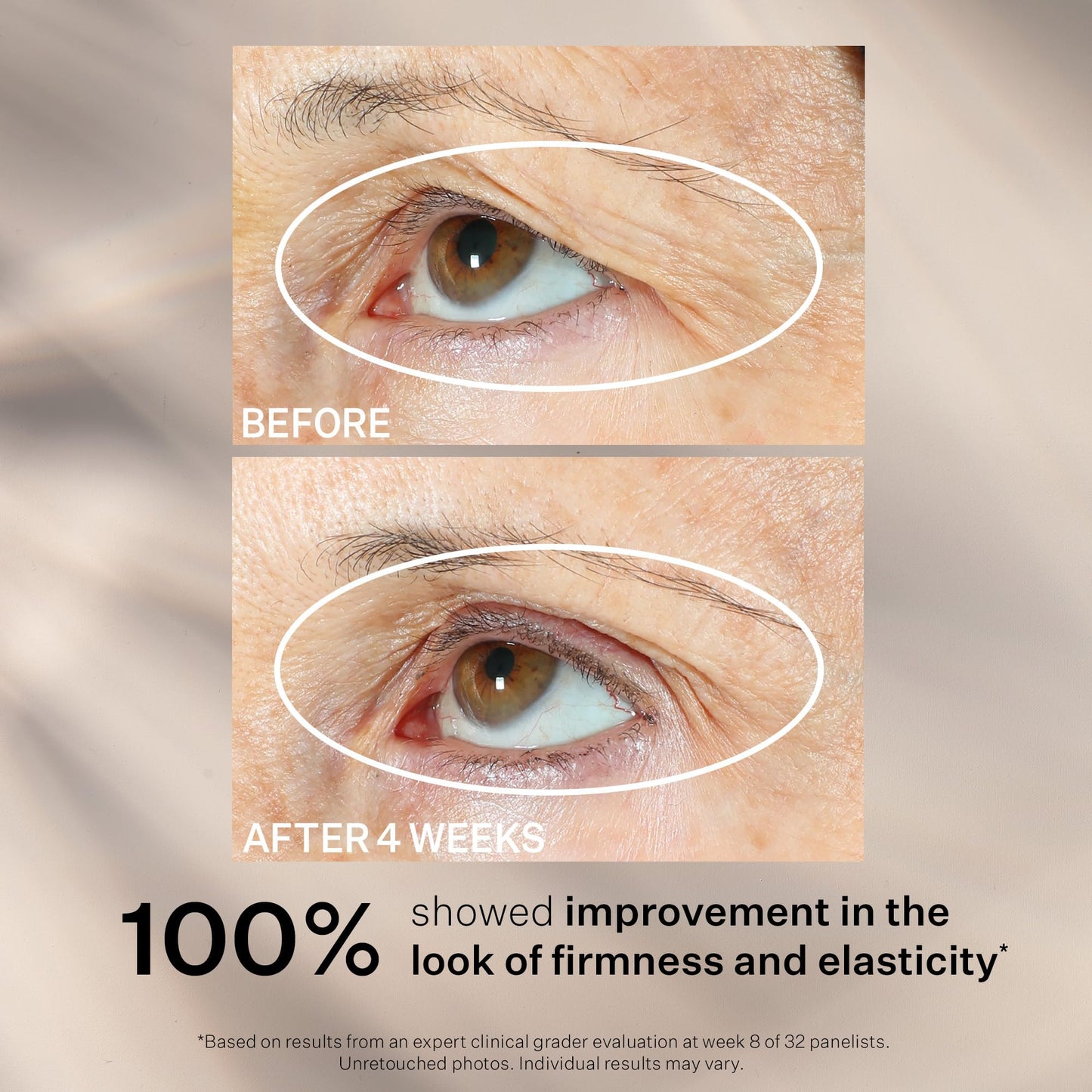 StriVectin Tighten & Lift Peptight Face Lift Serum with Tightening & Brightening Peptides for Wrinkles