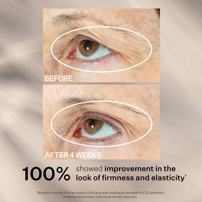 StriVectin Tighten & Lift Peptight Face Lift Serum with Tightening & Brightening Peptides for Wrinkles