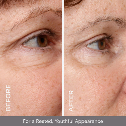 COSMEDIX Under Eye Serum for Dark Circles & Puffiness, Opti Crystal - Lifting & Firming Liquid Serum for Fine Lines & Wrinkles - Brightening, Moisturizing, & Hydrating Anti Aging Eye Puffy Bags Serum