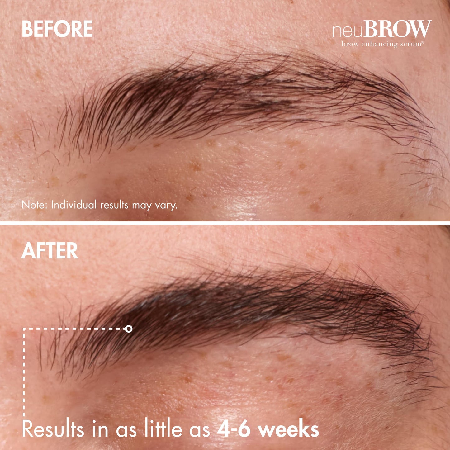 neuBROW Brow Enhancing Serum by Skin Research Laboratories - Eye Brow Serum for Defined, Fuller & Thicker-Looking Hair Brows - Advanced Formula Promotes Natural & Healthy Appearance of Brows