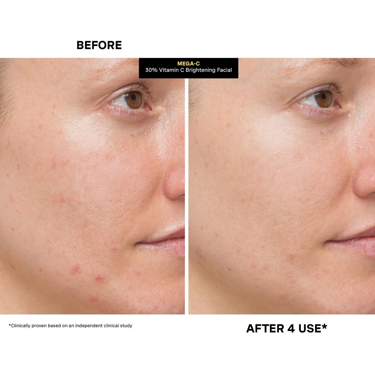 Kate Somerville Mega-C 30% Vitamin C Brightening Facial Mask – Clinic-Grade Treatment to Brighten, Even Skin Tone & Firm, 2 Fl Oz
