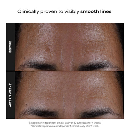 Paula's Choice SKIN PERFECTING 2% BHA Liquid Exfoliant with Salicylic Acid, Facial Polish for Enlarged Pores, Wrinkles & Fine Lines, Suitable for Blackhead-Prone Skin, Fragrance-Free