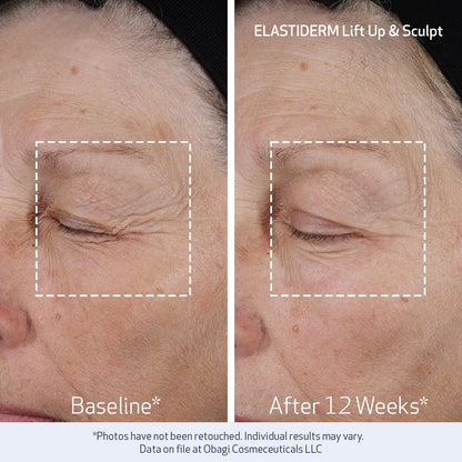 Obagi ELASTIDERM Lift Up & Sculpt Facial Moisturizer and Eye Cream Set – Clinically Proven Anti-Aging Face Cream 1.7oz & Lightweight Eye Cream .5oz Help Reduce the Appearance of Fine Lines & Wrinkles