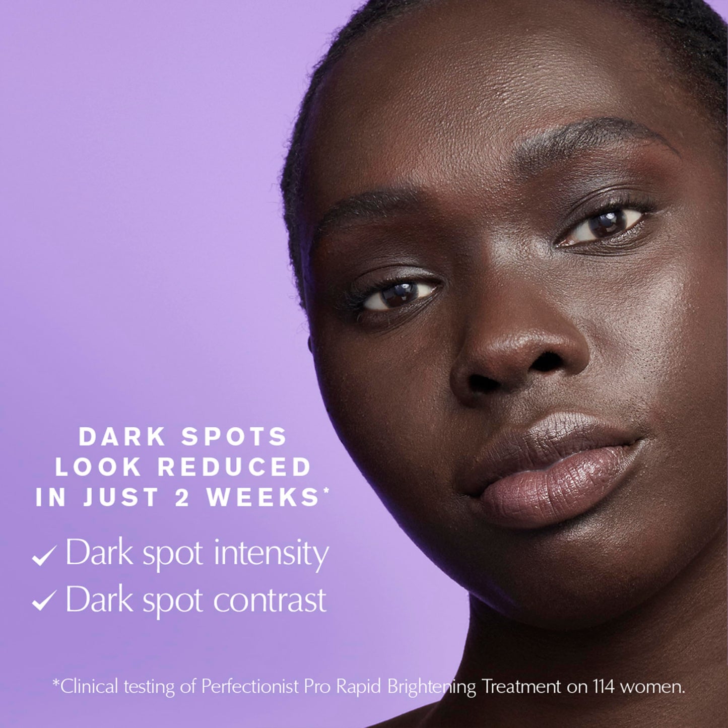 Estée Lauder Perfectionist Pro Rapid Brightening Treatment Face Serum with Ferment3 + Vitamin C | Targets Dark Spots