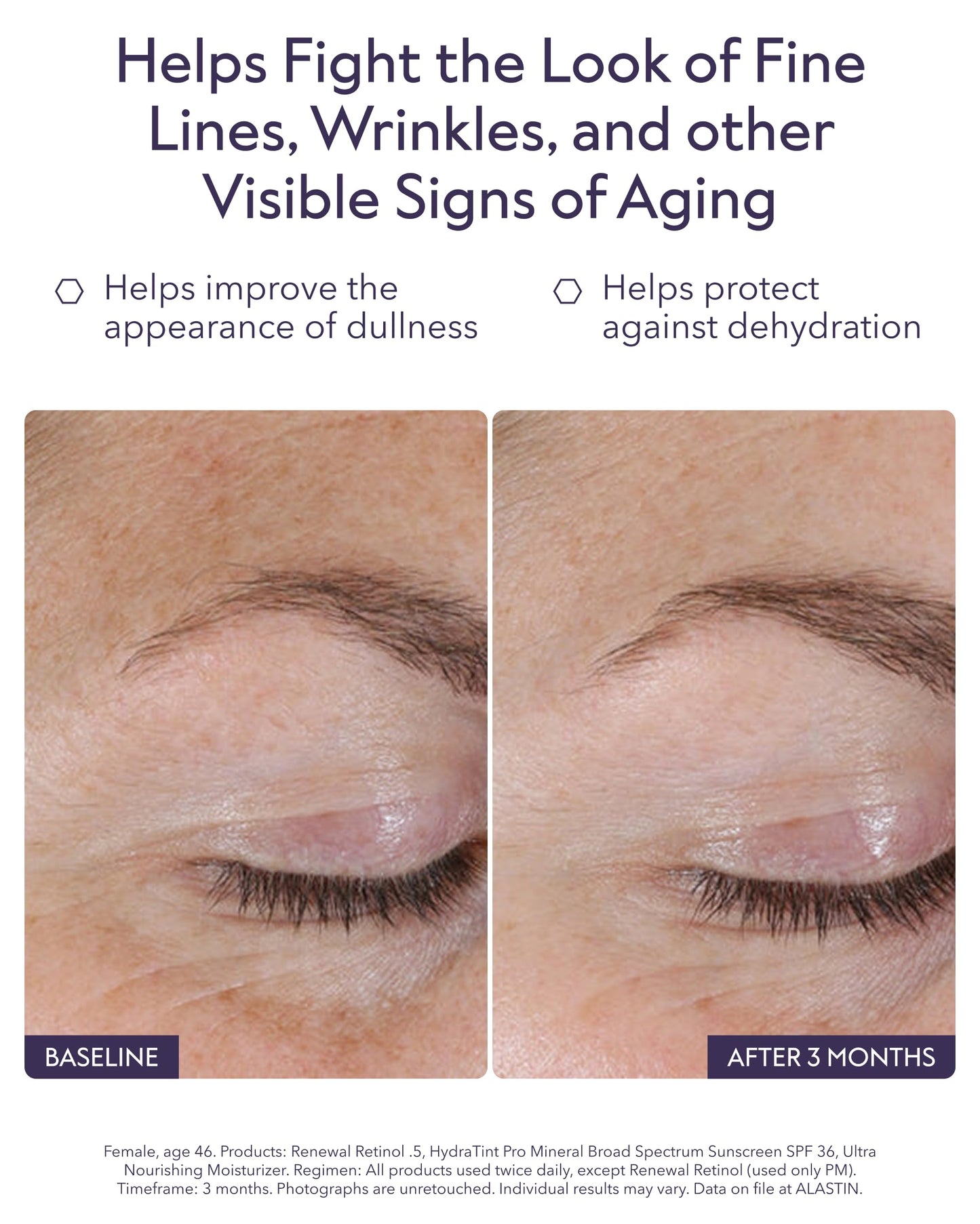 ALASTIN Skincare Renewal Retinol Serum | Visibly Improves Skin Texture & Tone | Helps Reduce the Look of Fine Lines & Wrinkles | Hydrating Retinol Formula
