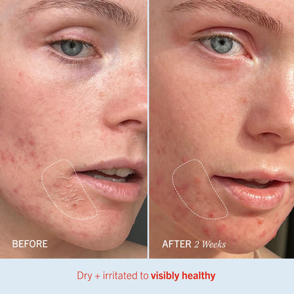 First Aid Beauty - Ultra Repair Cream, Intense Hydration Whipped Colloidal Oatmeal, Clinically Proven to Strengthen Skin Barrier in 7 Days & Helps Relieve Eczema, Luxury Face & Body Moisturizer, 2 oz