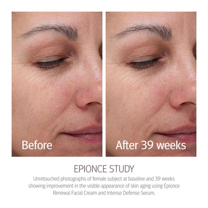 Epionce Renewal Facial Cream – Hydrating Anti-Aging Moisturizer | For Dry, Sensitive to Normal Skin | Fine Lines & Wrinkles | Dermatologist Skincare