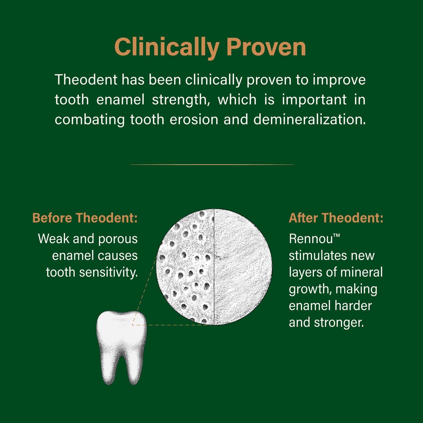 Theodent Classic with Rennou™: Fluoride-Free Theobromine Toothpaste for Proven Remineralization, Sensitivity Relief & Natural Whitening, Spearmint (3.4 Ounces, 96.4 Grams)