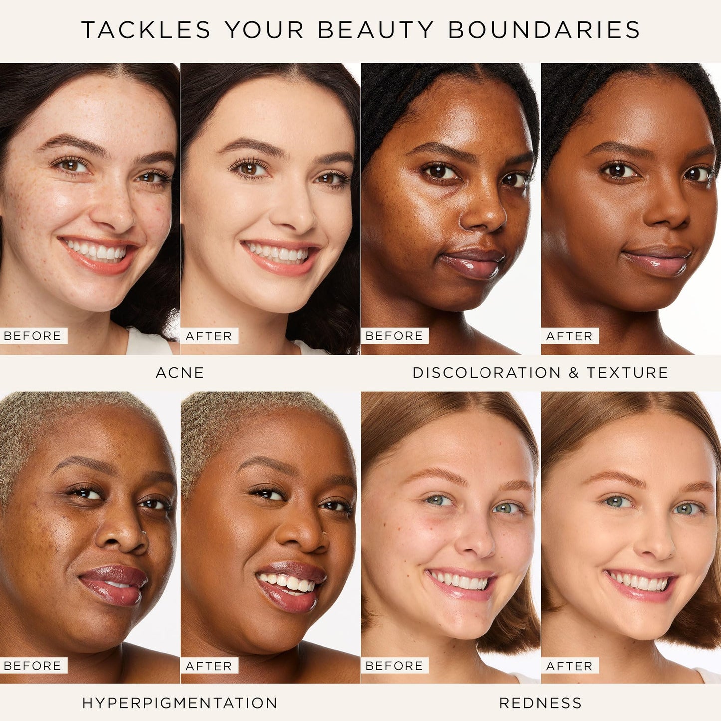 tarte shape tape concealer & brush – Instant Full Coverage for Under Eye, Dark Circles, Fine Lines, Redness & Discoloration, Dermatologist-Tested, Vegan, Cruelty Free