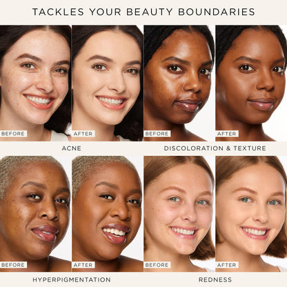 tarte shape tape concealer & brush – Instant Full Coverage for Under Eye, Dark Circles, Fine Lines, Redness & Discoloration, Dermatologist-Tested, Vegan, Cruelty Free