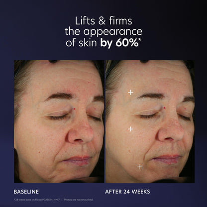 PCA SKIN Pro Max Age Renewal Anti Aging Serum, Anti Aging Face Serum for Reducing Wrinkles and Sagging Skin, Helps Lift and Firm Skin on Face and Neck, Safe For All Skin Types