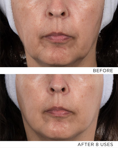 Noble Panacea Refill Exceptional Chronobiology