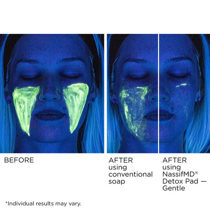 NassifMD Gentle Detox Pads, Surgeon-Created Fruit Acid Complex for Sensitive Skin, Brightens, Exfoliates & Reduces Wrinkles, Dermatologist-Tested