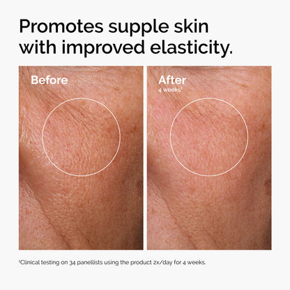 The Ordinary Hyaluronic Acid 2% + B5 (with Ceramides), Multi-Depth Hydration Serum for Plumper, Smoother Skin