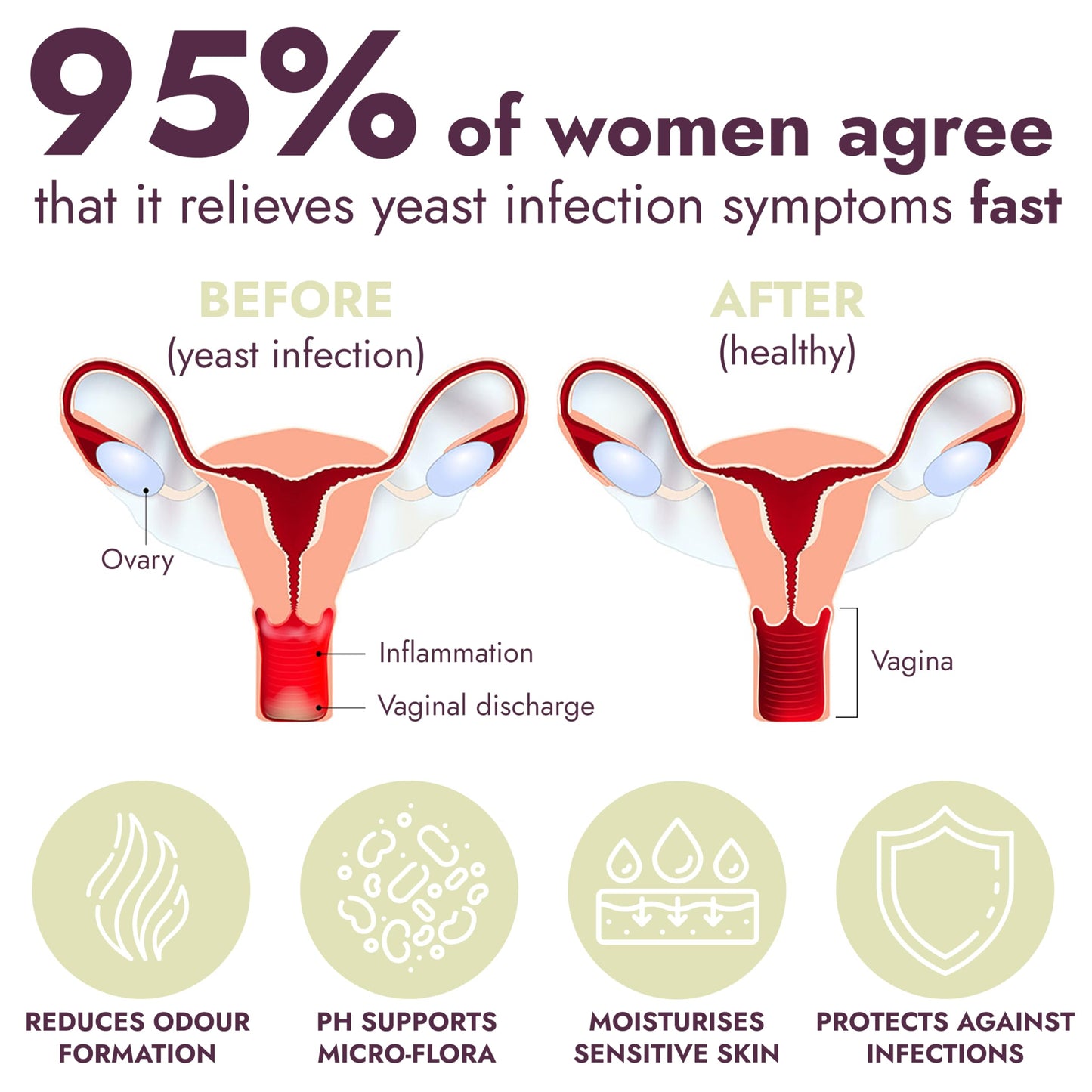 Terramed Just Think Comfort Vaginal Probiotic Gummies for Women + Yeast Infection Treatment with Borax – Comprehensive Support for pH Balance, Odor Control, and Yeast Infection Relief