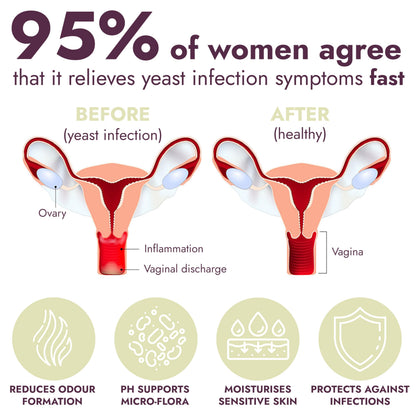 Terramed Just Think Comfort Vaginal Probiotic Gummies for Women + Yeast Infection Treatment with Borax – Comprehensive Support for pH Balance, Odor Control, and Yeast Infection Relief