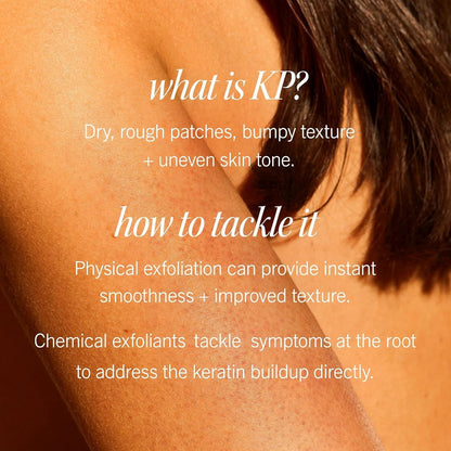 First Aid Beauty - KP Bump Eraser Body Scrub with 10% AHA, Keratosis Pilaris Skin Exfoliater with Glycolic and Lactic acids, Helps Reduce Chicken Skin Bumps, Safe for Sensitive Skin, 10 oz