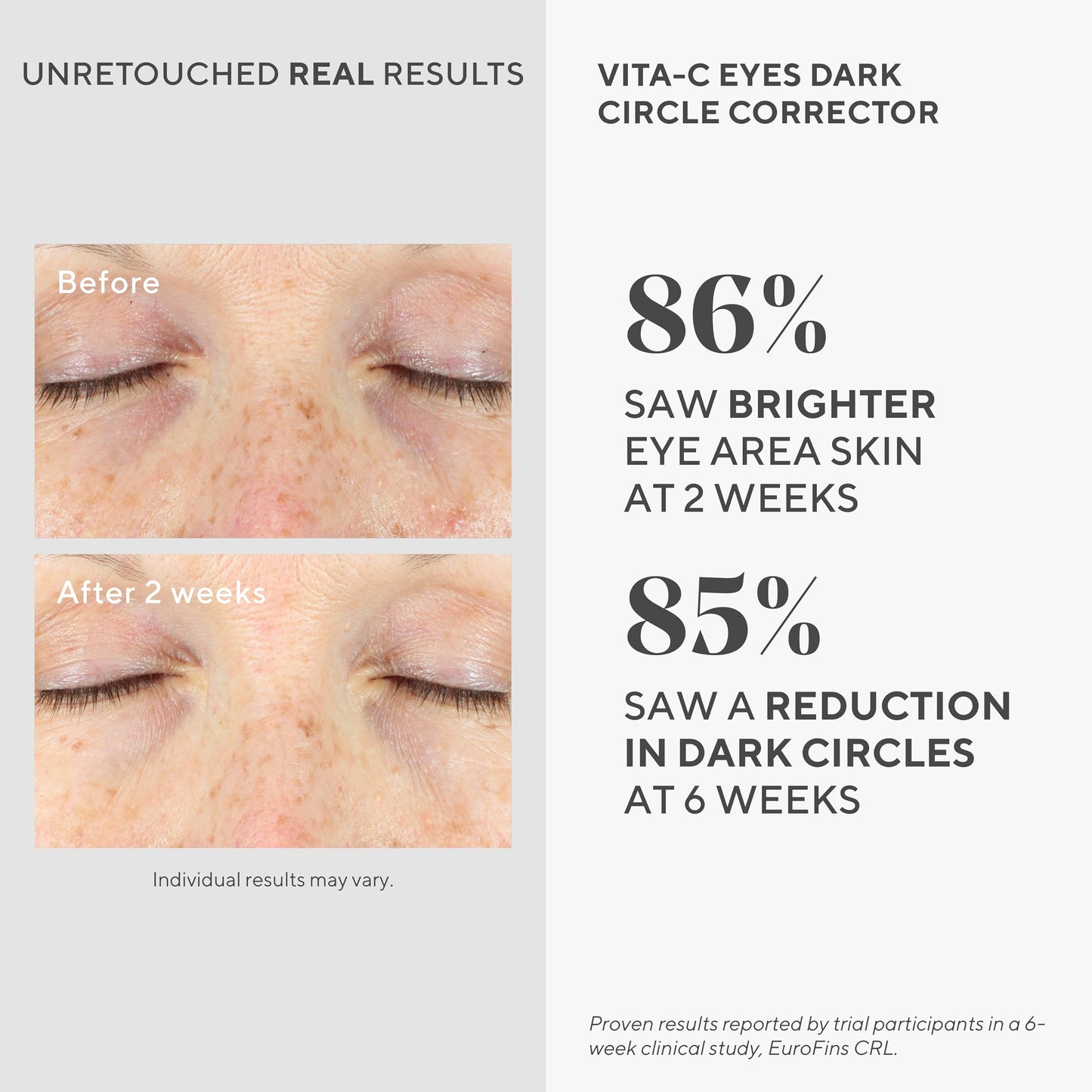Murad Vita-C Eyes Dark Circle Corrector – Gold-Stabilized Vitamin C, Algae, and Cucumber Eye Serum for Brightening, Reducing Puffiness, and Smoothing Fine Lines – 0.5 Fl Oz