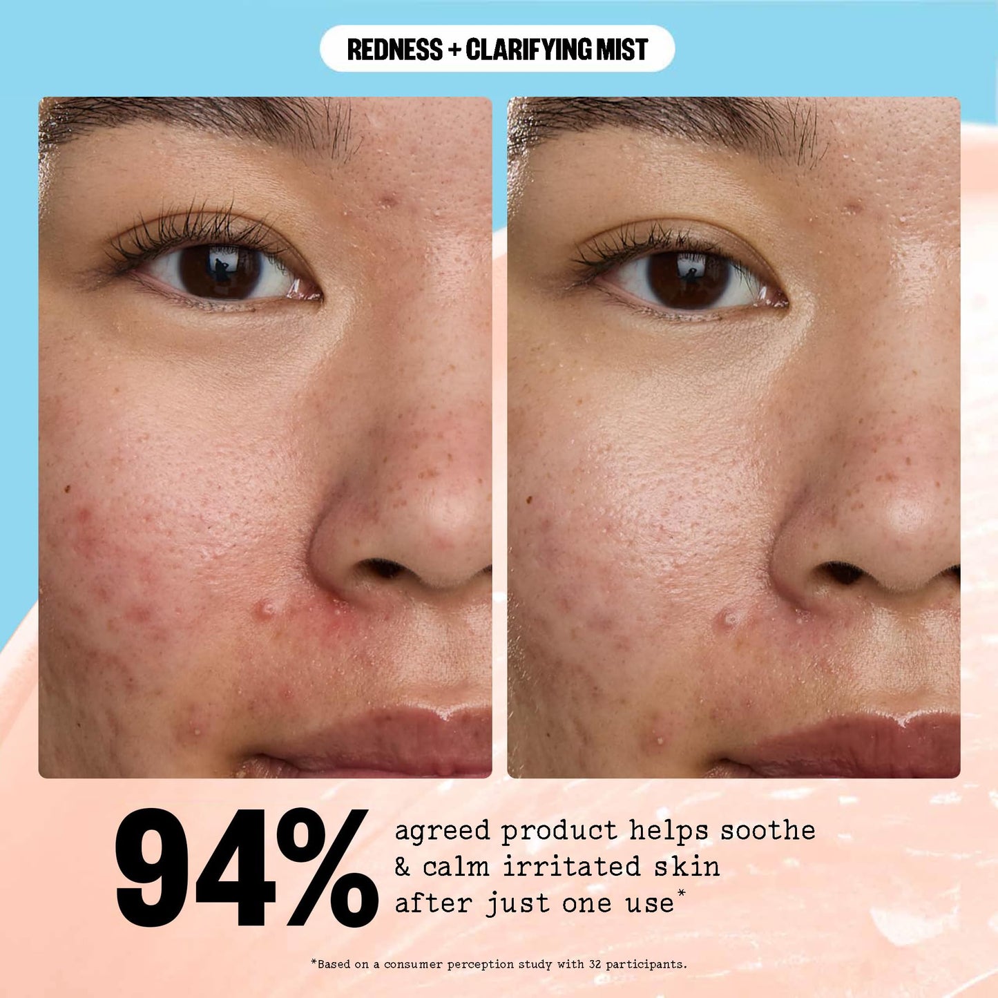PEACE OUT Redness + Clarifying Mist, Hypochlorous Acid Facial Spray for Acne-Prone Skin, Helps Calm Redness, Control Excess Oil, and Refresh Skin Over and Under Makeup, 3.3 fl oz