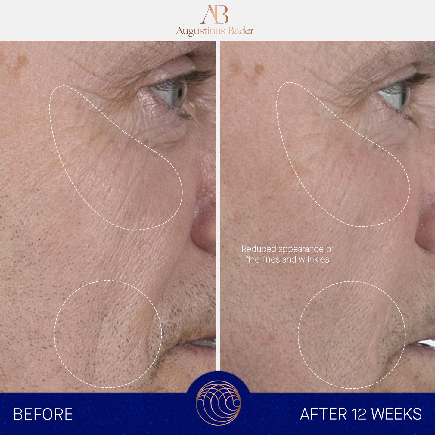 Augustinus Bader The Serum – Luxury Hydrating Anti-Aging Face Serum – Boosts Firmness, Smooths Fine Lines & Evens Skin Tone