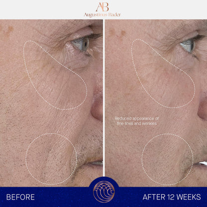 Augustinus Bader The Serum – Luxury Hydrating Anti-Aging Face Serum – Boosts Firmness, Smooths Fine Lines & Evens Skin Tone
