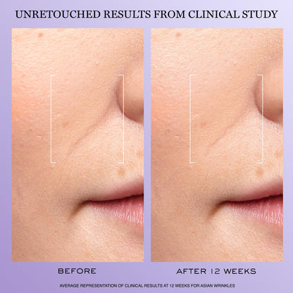 Lancôme Rénergie H.C.F. Triple Serum - Hyaluronic Acid Serum for Visible Correction of Anti Aging Signs & Dark Spots - With Vitamin C+, Niacinamide & Ferulic Acid