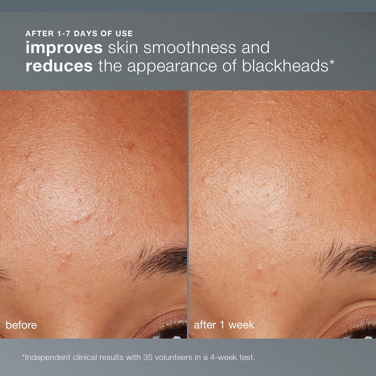 Dermalogica Daily Microfoliant, Face Exfoliator Scrub Powder with Salicylic Acid and Papaya Enzyme, Achieve Brighter, Smoother Skin Daily