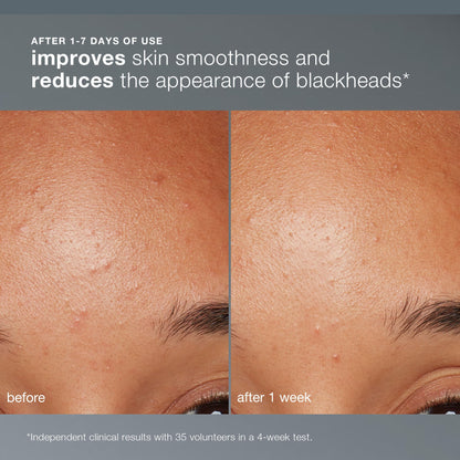 Dermalogica Daily Microfoliant, Face Exfoliator Scrub Powder with Salicylic Acid and Papaya Enzyme, Achieve Brighter, Smoother Skin Daily