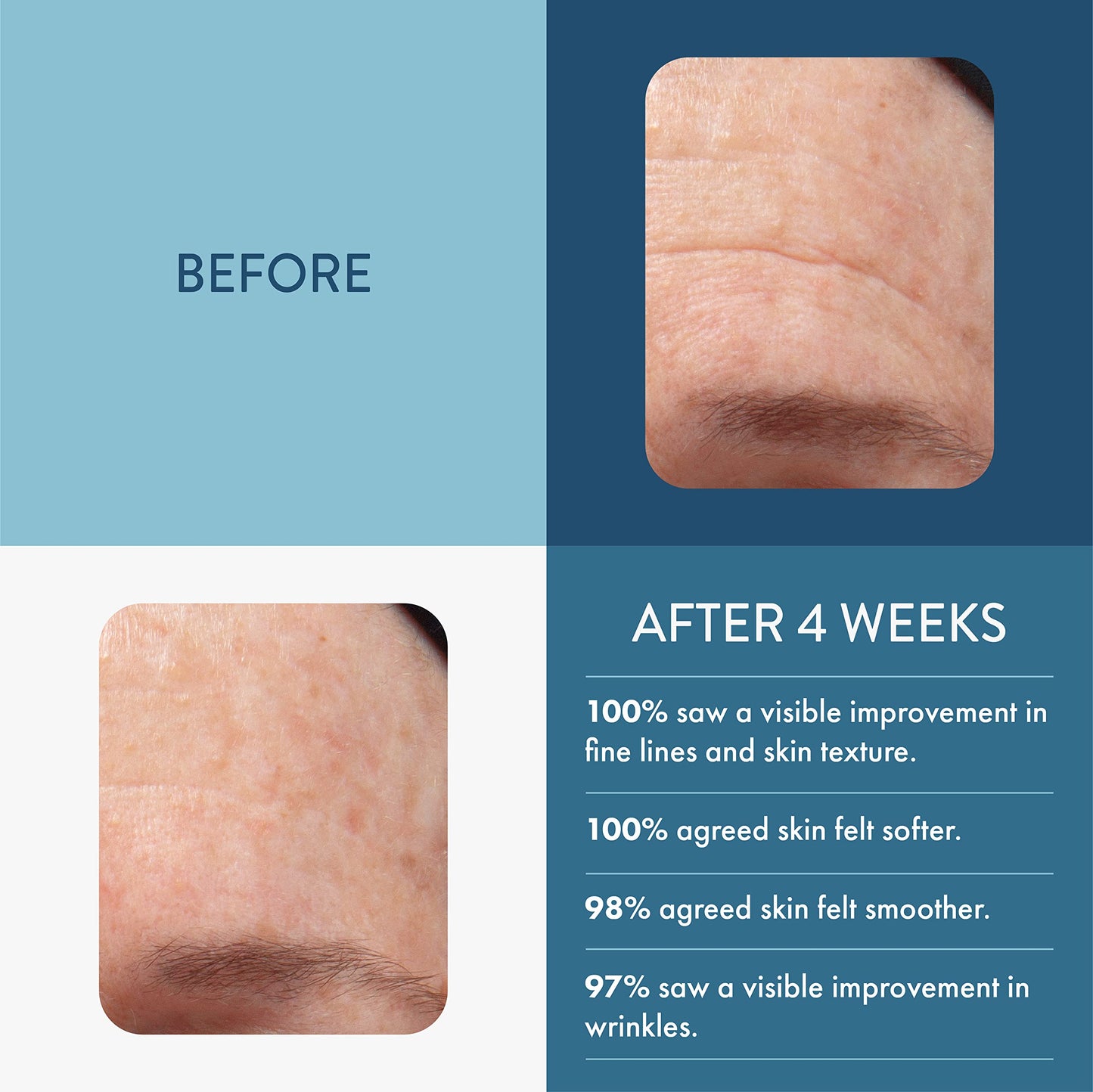 Lancer Skincare The Method Intro Kit, 3-Step Facial Exfoliator, Cleanser, and Moisturizer Kit for Oily or Congested Skin