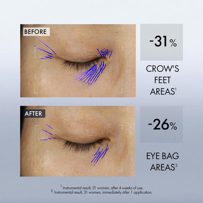 Lift Firm Dual Eye Treatment