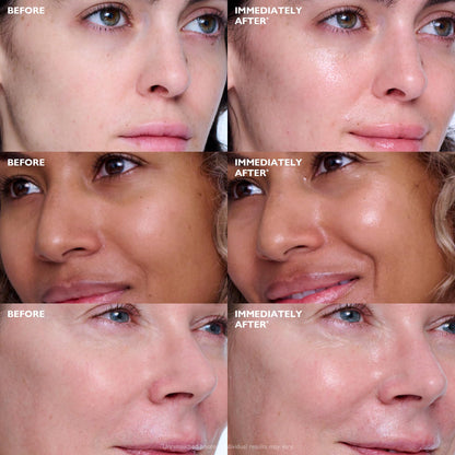 Peter Thomas Roth | Collagen Skinjection™ Plumping & Firming Serum | Skin Barrier Serum, Exosome Serum For Face, Collagen Peptides Serum