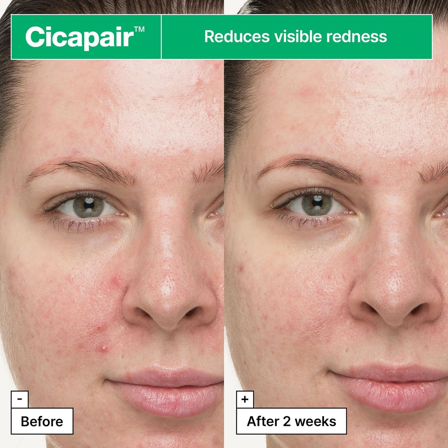 Dr.Jart+ Cicapair So Soothing Face Treatment Korean Gel Cream for Visibly Irritated Skin with Centella Asiatica | Korean Skin Care, 1.01 Fl Oz