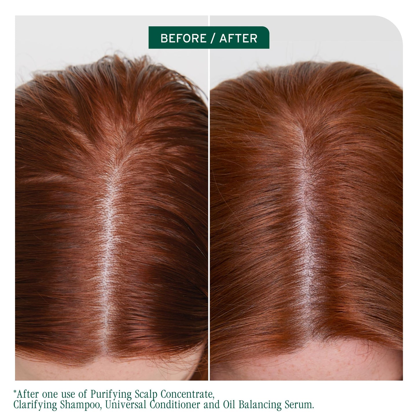 Biolage Scalp Sync Clarifying Shampoo - Residue & Buildup Remover, For Oily Scalp