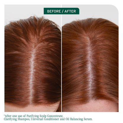 Biolage Scalp Sync Clarifying Shampoo - Residue & Buildup Remover, For Oily Scalp