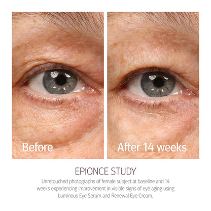 Epionce Renewal Eye Cream - Anti-Aging, Under Eye Cream for Dark Circles, Fine Lines, Wrinkles & Puffiness with Hyaluronic Acid, For All Skin Types, Dermatologist Skincare