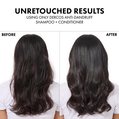 Dercos Hair & Scalp Moisturizing Conditioner, Formulated With Glycerin, Niacinamide + Hyaluronic Acid, Hair Conditioner & Scalp Moisturizer, Strengthens, Post Dandruff Treatment, 6.7 Fl Oz
