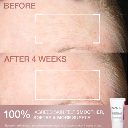 StriVectin Skin Care Holiday Gift Kits, Beauty Routine Gift Sets - Brightening, Smoothing & Hydrating Skin Care Stocking Stuffers
