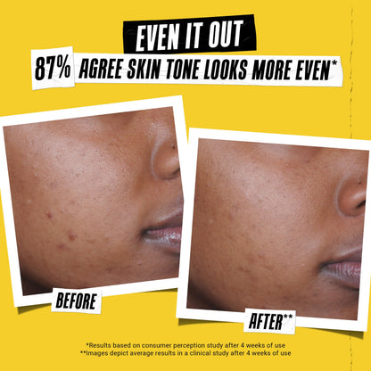 Kiehl's Better Screen UV Serum SPF 50+, Invisible Facial Sunscreen with Collagen Peptide, UV Filters to Shield UVA & UVB, Helps Correct Visible Signs of Aging, Boosts Skin Radiance