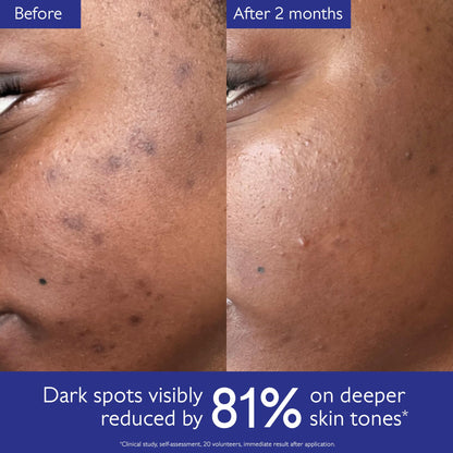 Caudalie Vinoperfect Brightening Dark Spot Serum Vitamin C Alternative - 62x More Effective than Vitamin C with Viniferine for a Visibly Brighter Even Complexion