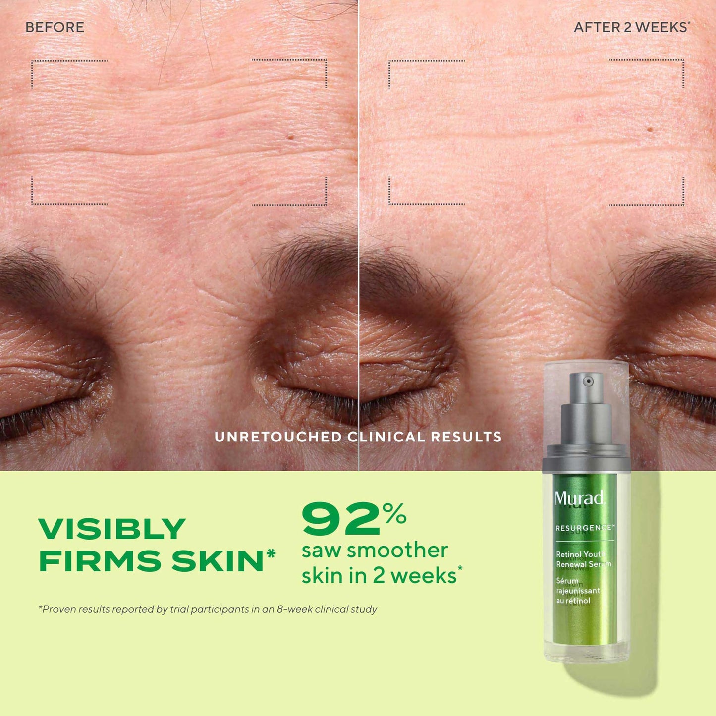 Murad The Wrinkle Fighter – 2‑Piece ($141 Value) - Retinol Youth Renewal Kit (Full + Travel Size) – Tri‑Active Retinol, Swertia & Hyaluronic Acid – Fast‑Acting Anti‑Aging Serum – Firms & Smooths Skin