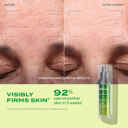 Murad The Wrinkle Fighter – 2‑Piece ($141 Value) - Retinol Youth Renewal Kit (Full + Travel Size) – Tri‑Active Retinol, Swertia & Hyaluronic Acid – Fast‑Acting Anti‑Aging Serum – Firms & Smooths Skin