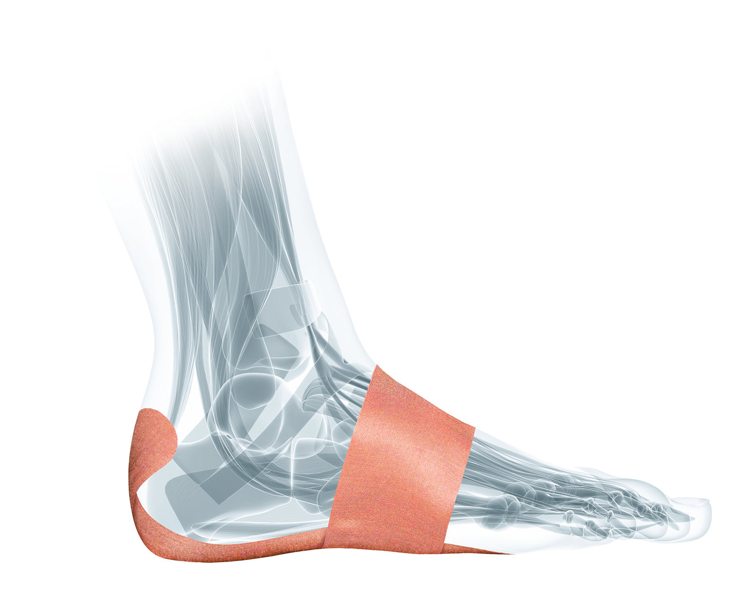 MUELLER Sports Medicine PFTape, Plantar Fasciitis Pain Relief Athletic Tape, Therapeutic Support for the Foot, Disposable, Latex Free, One-Time Use Bandages