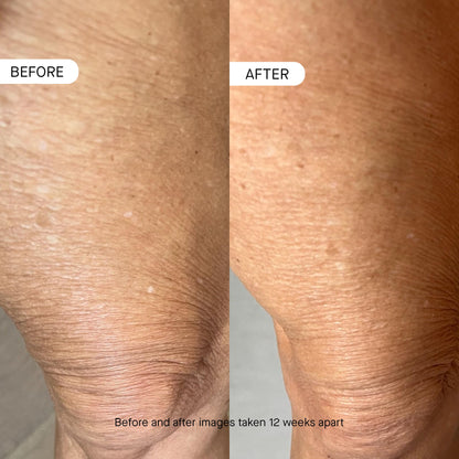 oneskin BODY OS-01 Peptide Topical Supplement & Skin Longevity Age Reversal Moisturizer | Safe for Sensitive Skin, Fragrance-Free, 250 mL / 8.45 oz