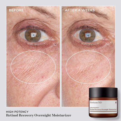 High Potency Classics Retinol Recovery Overnight Moisturizer