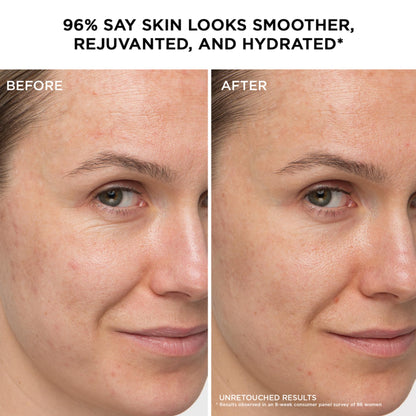 IT Cosmetics Confidence in a Cream - Hydrating & Anti Aging Face Moisturizer, Visibly Reduces Fine Lines & Wrinkles, Up To 48H Hydration, Repairs Skin Barrier, Squalane & Ceramides, For All Skin Types